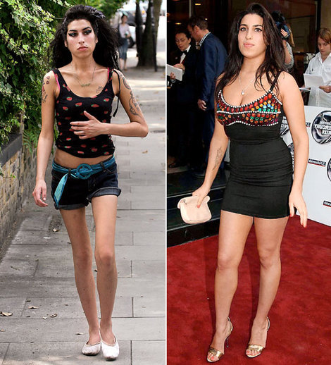 Amy Winehouse- before and after drugs.