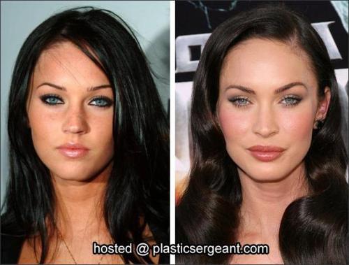 megan fox before and after plastic. hair Nicki Minaj Plastic Surgery megan fox before and after plastic.