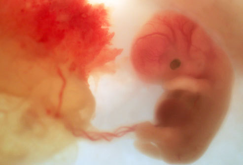 fetus at 6 weeks. Photo of an 8 week old fetus,
