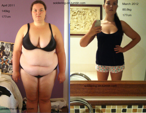 letsgetshredded: positive-happiness-progress: iy-fit: spaztasticallyawesome: mylovelyweightloss: girlgrowingsmall: soldiering-on: Before - During Adding this to my favorite B&amp;As folder. this is amazing Holy, good job! *~* This deserves a million notes!!! Just wow! Thats almost a year of work. No one gets results over night. Wow! Sweet Jesus you are officially my inspiration! *.* 